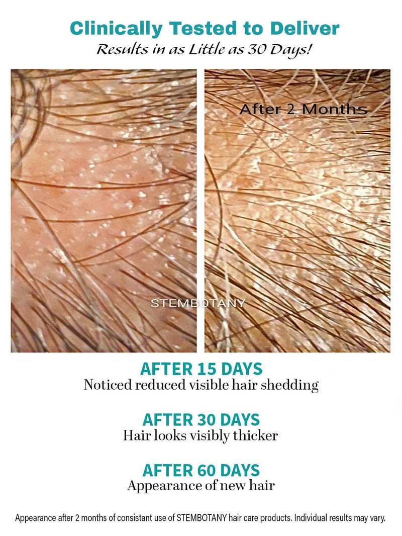 BIOCELLMED Copper Peptide Absolute GROW® Scalp Serum with Copper Peptides and Plant Stem Cells for Hair, 1.05 oz