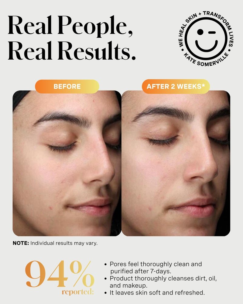 Kate Somerville ExfoliKate Cleanser – Daily Exfoliating Foaming Face Wash, Clinically Formulated Glycolic Acid and Lactic Acid Gentle Facial Scrub, Travel-Size, 1.7 Fl Oz