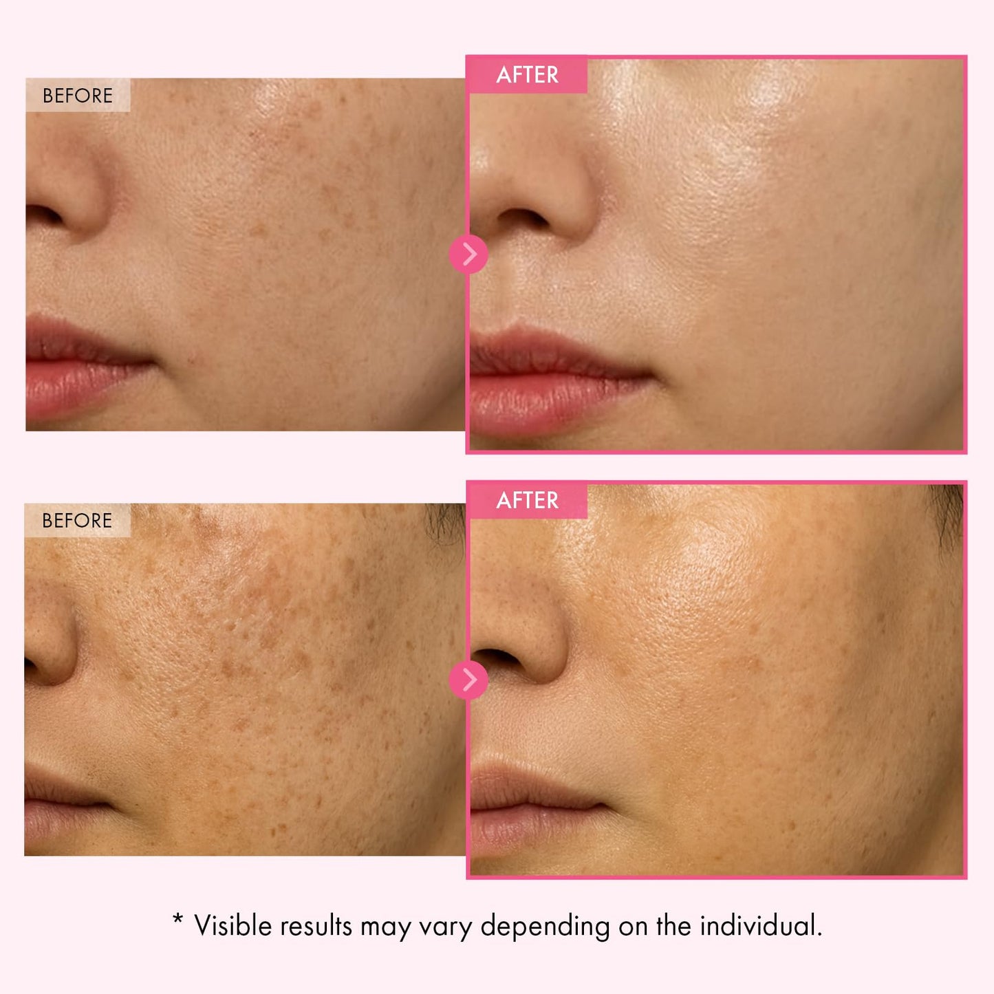 TOSOWOONG Arbutin 7% Glutathione Cream, 70,000ppm Arbutin + 5,001ppm Glutathione, Niacinamide, Dark Spots, Freckle, Blemishes, Pigmentation, Dullness, Uneven Tone, Korean Skin Care, 50ml, 1.69 fl.oz.