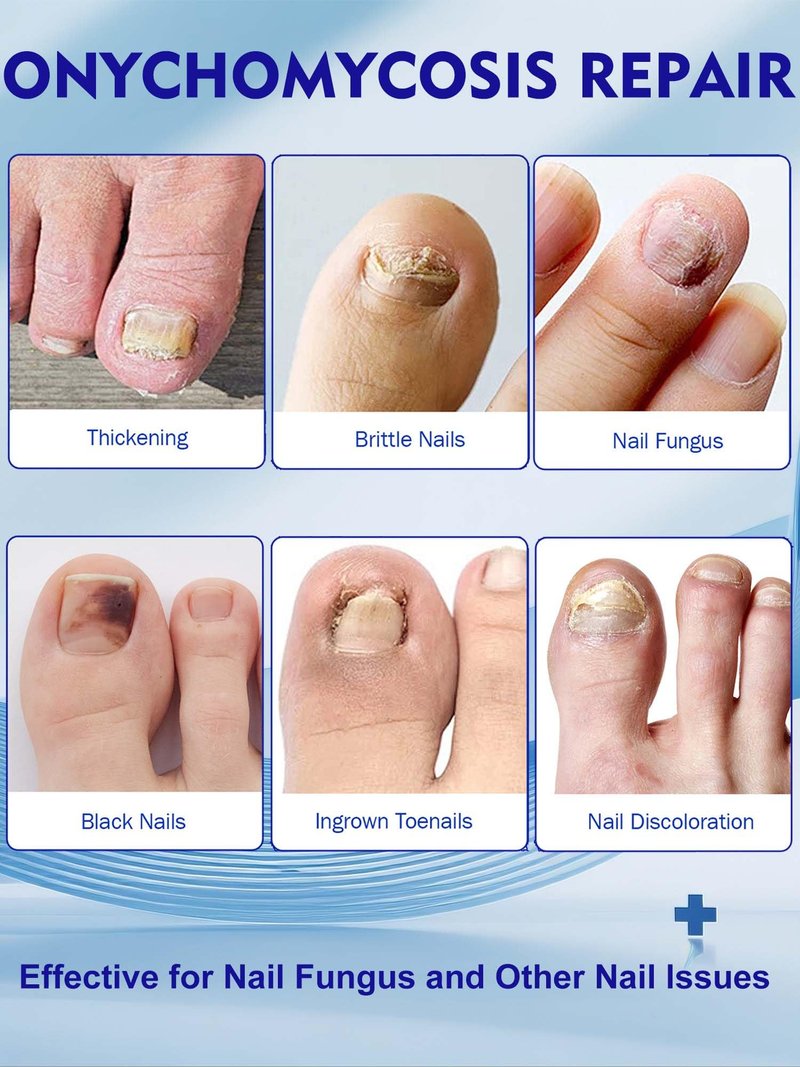 Nail Patches Toenail Treatment Extra Strength 8-Hour Overnight Nail Fast Acting Repair Effortless Hydrogel Nail Care and Repair for Damaged Nails Overnight Renewal for Men and Women (48 Count)