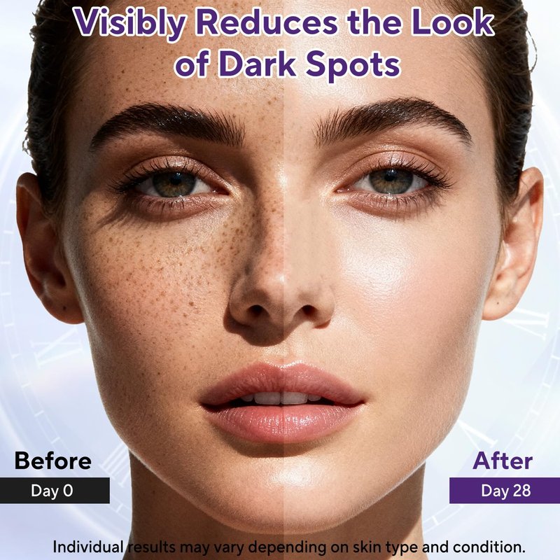 Jessasjet Dark Spot Remover for Face & Body, Advanced Corrector Cream with Niacinamide, Retinol, Arbutin, Hyaluronic Acid & Vitamins B5 C E, Fade Age Spots, Sun Spots, Freckles (1.69 Fl Oz)