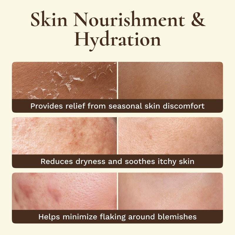Beef Tallow Face Moisturizer - Whipped Grass-Fed Balm with Raw Honey & Beeswax | Hydrating Cream for Dry, Sensitive Skin