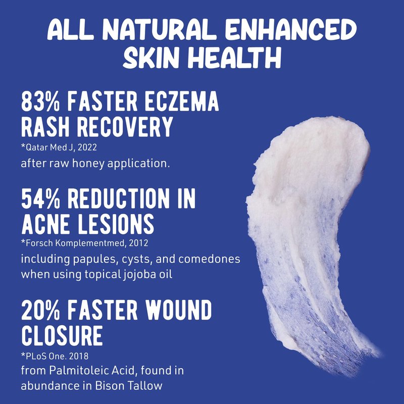 Grazly Whipped Bison Tallow Balm w/Manuka Honey, Jojoba, Organic Vanilla - Grass-Fed & Finished Organic Tallow Face Moisturizer - Face & Body Cream for Acne-Prone Skin - Nourishing Skincare (2.5 oz)