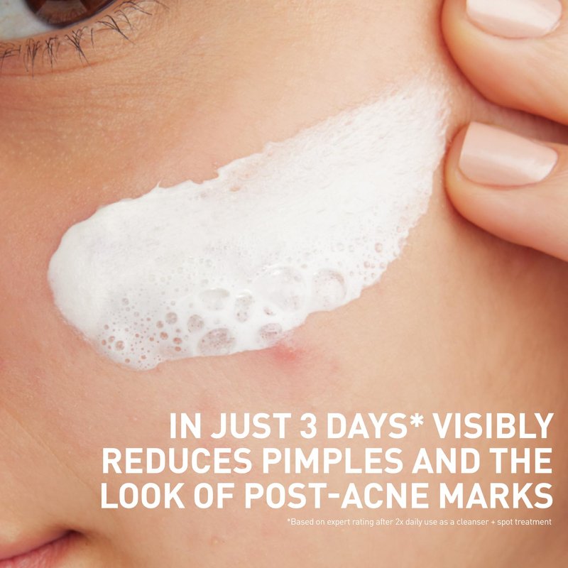 CeraVe Clay To Foam Acne Face Wash, Multi-Use Salicylic Acid & Kaolin Clay Acne Spot Treatment Clears Pimples & Blackheads, Prevents Breakouts, Hydrates & Soothes, Fragrance-Free, Non-Comedogenic, 4oz