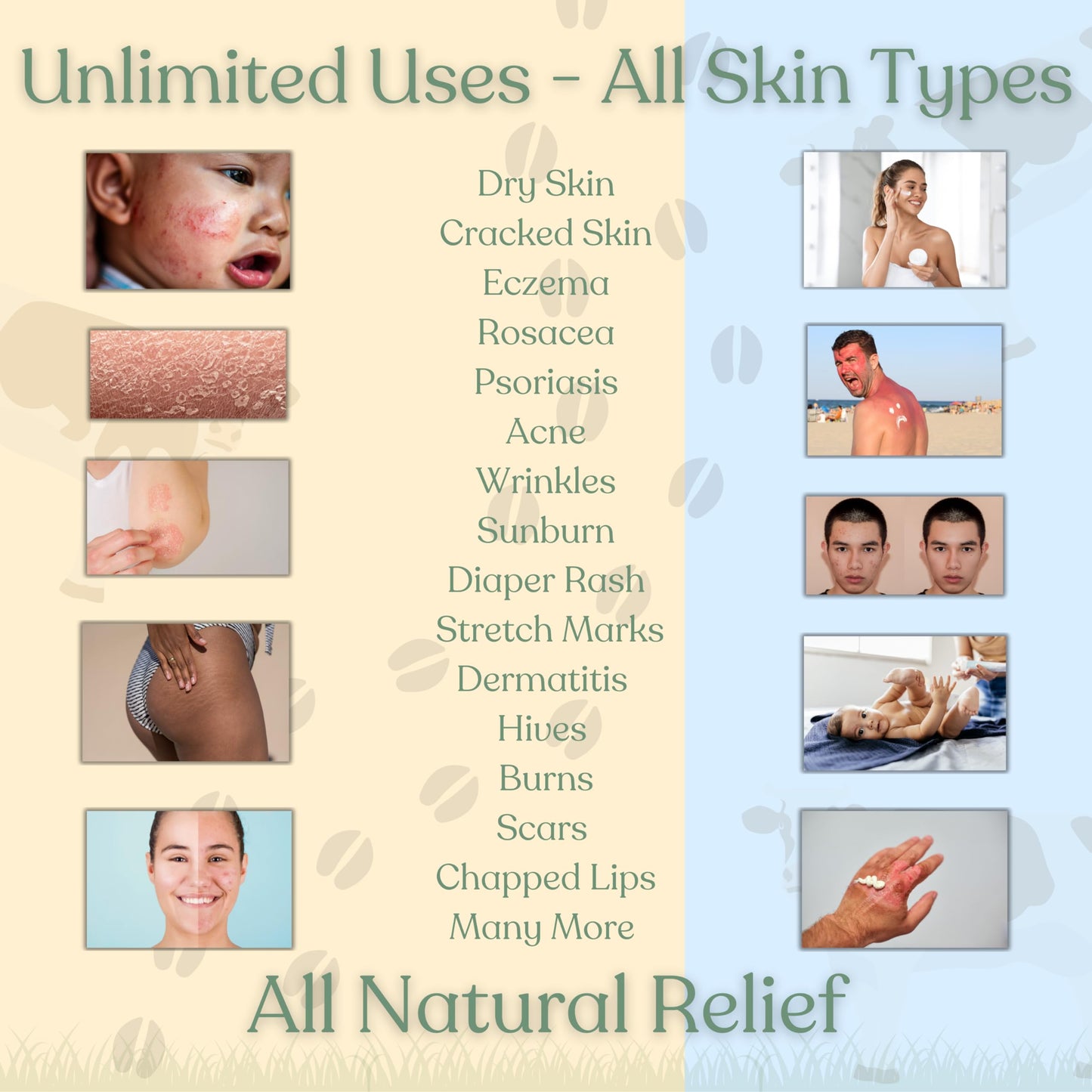 Reroot Organics Beef Tallow Balm for Skin | NAKED TALLOW BALM | 1 Ingredient - 100% Grass Fed Grass Finished Tallow | Whole Body & Face Moisturizer | Whipped | Dry Skin, Eczema, Rosacea, (2oz)