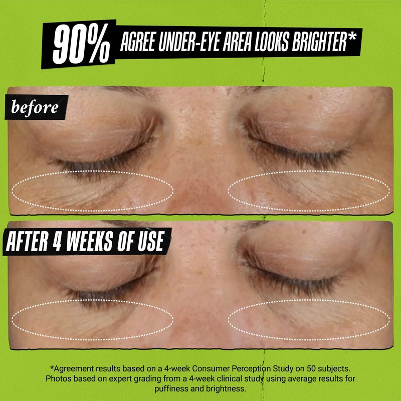 Kiehl's Avocado Eye Cream, Daily Under Eye Tightener & Brightener, Instantly Reduces Dark Circles and Puffiness, Anti-Aging Skincare with Caffeine for Undereye Bags and Dark Circles, Non-Toxic Formula
