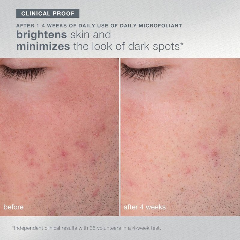 Dermalogica Travel-Sized Skin Care Set | Exfoliants, Serum & SPF Moisturizer for Radiant Skin