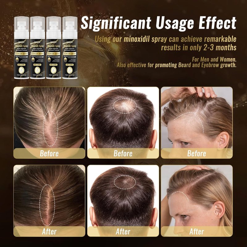 Minoxidil Spray for Hair Growth - Extra Strength 5% Formula with Biotin & Castor Oil | 4-Month Supply (4 Pack, 8.12 oz)