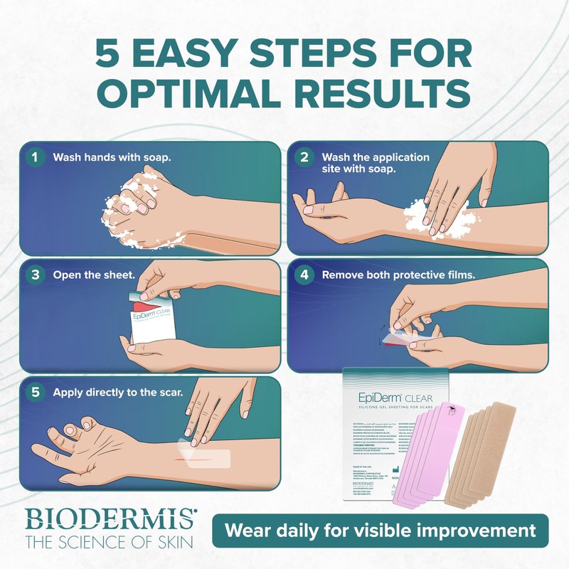 Epiderm Silicone Gel Strips - Silicone Tape for Scar Care - C Section, Tummy Tuck Tape & Cardiac Surgery Scars - Flexible & Reusable Strips - 1.4"x6" Clear