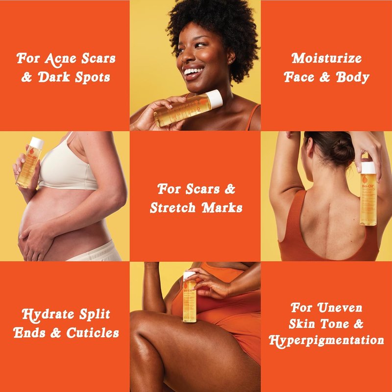 Bio-Oil Natural Skincare Oil - Serum for Scars & Stretch Marks | Face & Body Moisturizer, 4.2 Oz