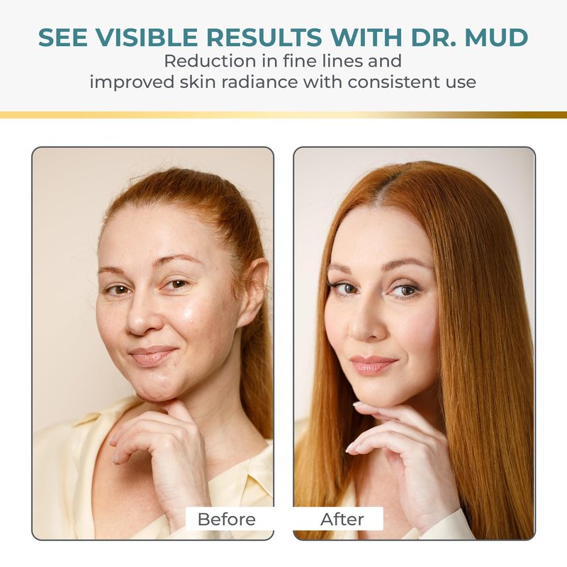 Dr Mud Anti aging Brightening Serum for Wrinkles, Dark Spots, Eye Area & Fine Lines - with Dead Sea Minerals, Hyaluronic Acid, Aloe Vera, Vitamin E & Vitamin A, Caster, Jojoba & Sesame Oil - 50 ml