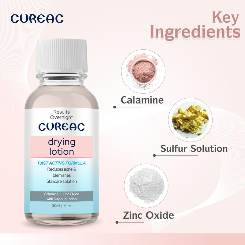 Salve Cureac Drying Lotion with Calamine, Zinc Oxide & Sulphur - 30 ml / 1.01 fl oz | Acne & Spot Care Lotion for Clear & Balanced Skin