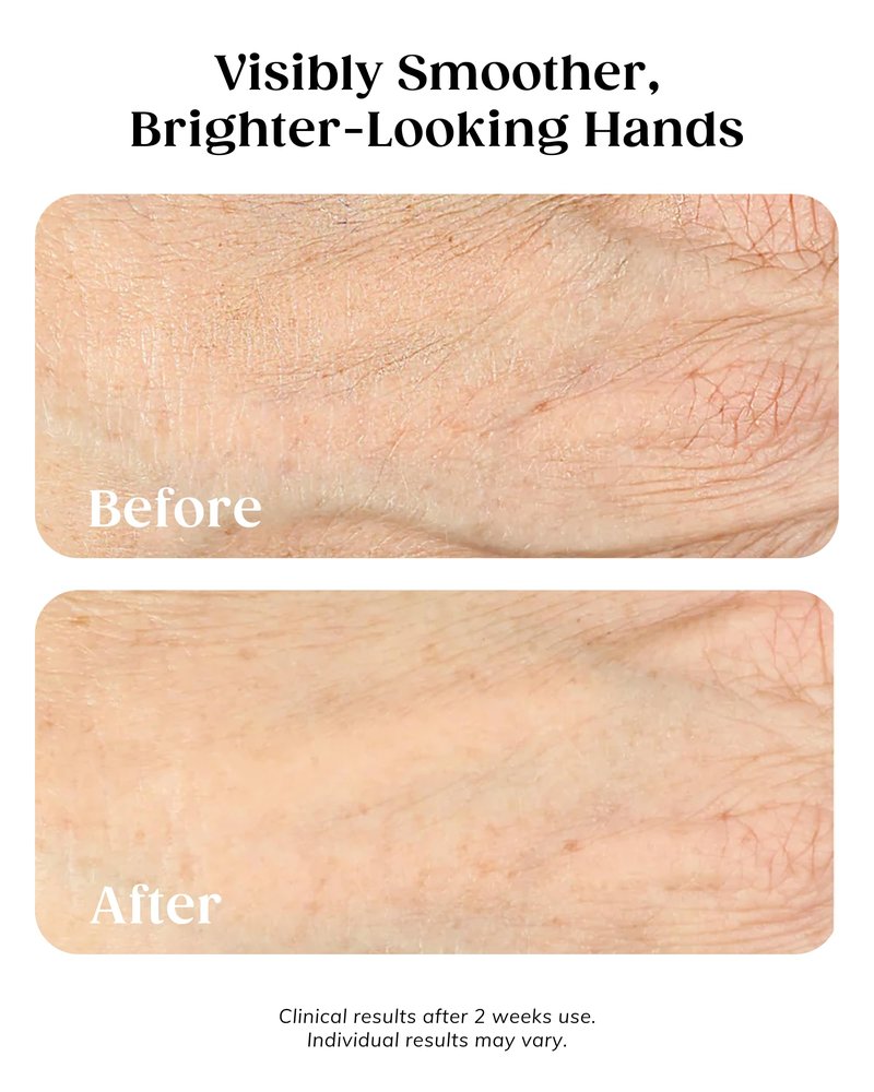 KAPLAN MD Anti Aging Hand Cream Treatment - 5 Essential Moisturizers Diamond Contour Intensive Hand Cream for Women with Vitamin C, Crushed Diamonds & Argireline - Dermatologist-Developed