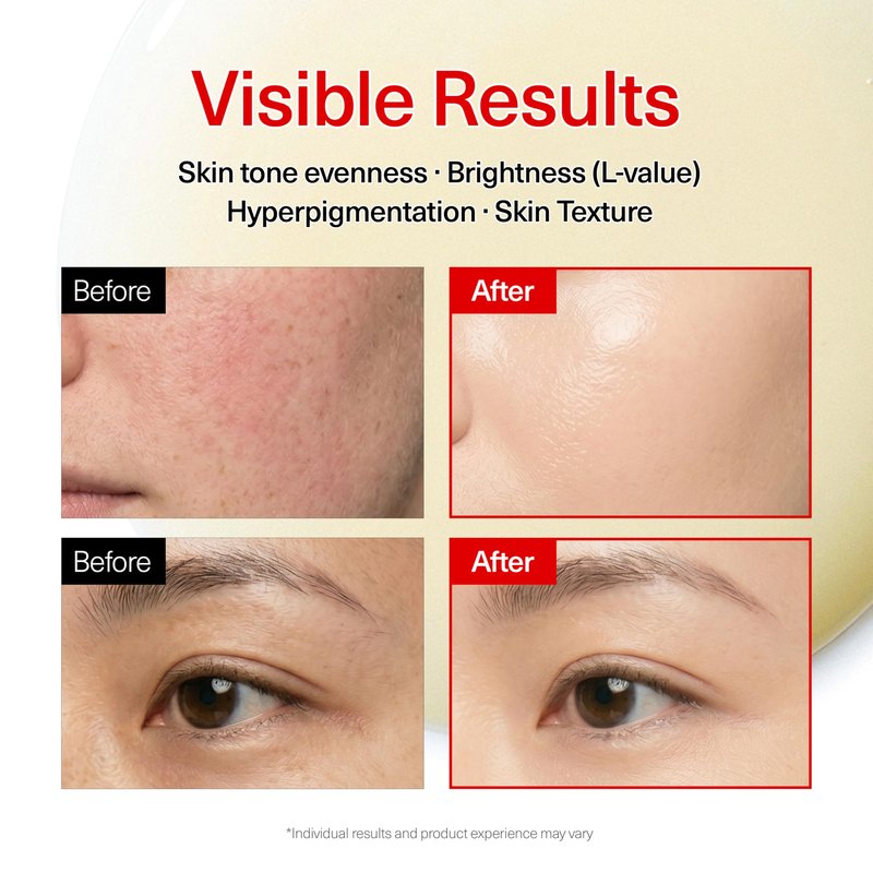 INFODPLUS Advanced Toning Serum with Tranexamic Acid, Intensive Dark Spot Discoloration and Uneven Tone Care, Niacinamide, Retinol Complex for Radiant Glow Facial Serum Korean Skincare 1.01 fl oz