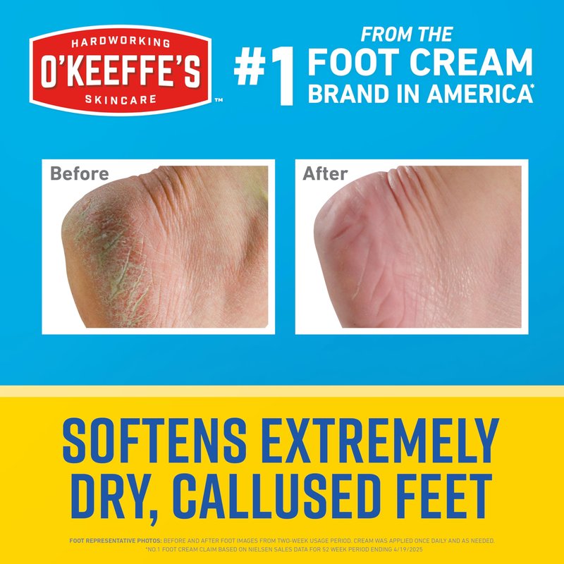 O'Keeffe's for Healthy Feet Intense Renewal Cream with Urea & Alpha Hydroxy Acid - 3 oz Tube (1 Pack) - Chemically Exfoliates and Softens Extremely Callused, Dry Feet