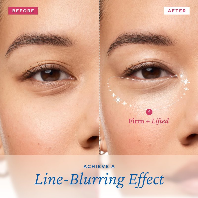 belif Retinol Firming Eye Serum – Aqua Bomb Lifting Eye Gel with Collagen & Bakuchiol for Puffiness, Fine Lines & Wrinkles, Peptide & Hyaluronic Acid, Korean Skin Care
