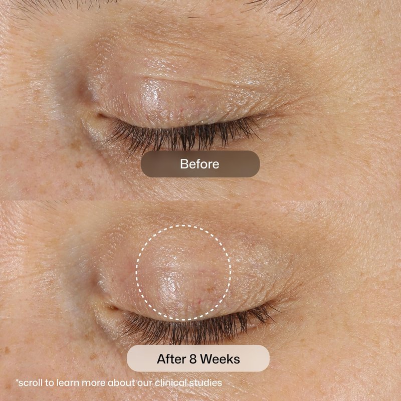 Revision Skincare D·E·J Eye Cream®, Clinically Proven to Reduce Under-Eye Fine Lines and Wrinkles with Peptides and Hyaluronic Acid for a Firmer, Smoother Eye Area, 0.5 fl oz Applicator