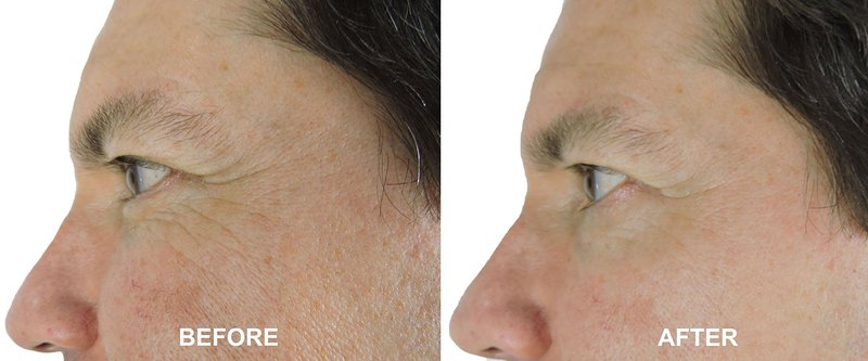 DNA Code®-No Needle Alternative-Argireline Copper Peptide Wrinkle Reduce Serum Booster w/Snap-8, Matrixyl 3000