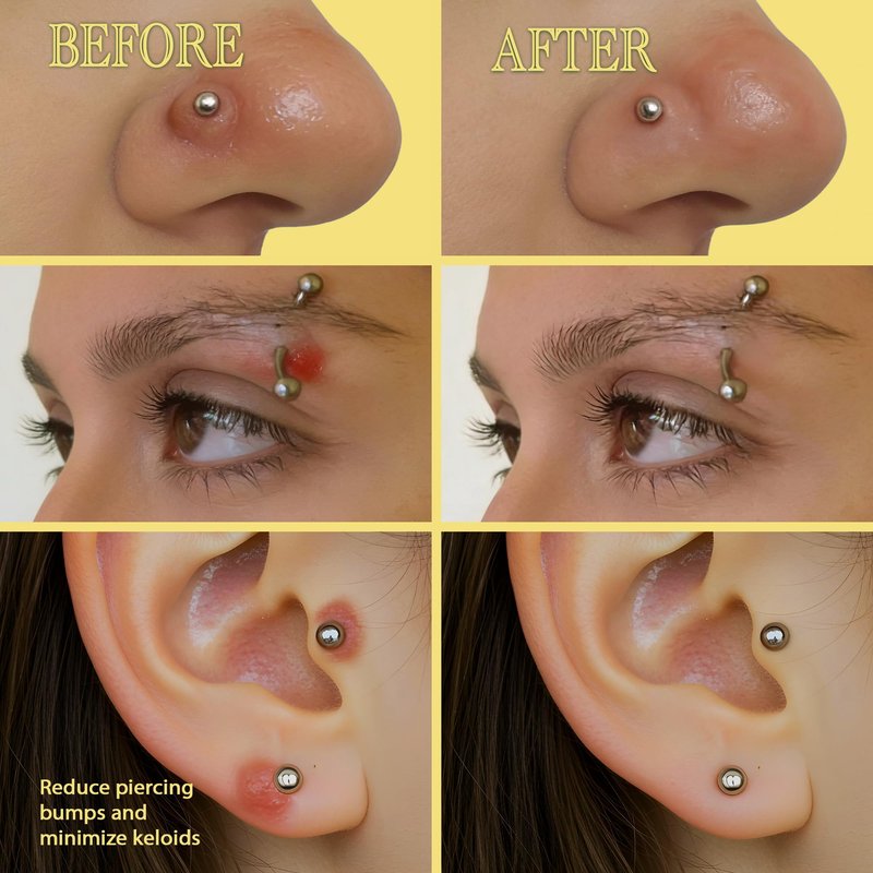 BodyJ4You Keloid Bump Removal Oil - Piercing Aftercare Shrinking Drops - Nose Ear Septum Belly Cartilage Scar Treatment Piercing Bump Solution - Tea Tree Jojoba Essential Oils Keloid Care (Pack of 4)