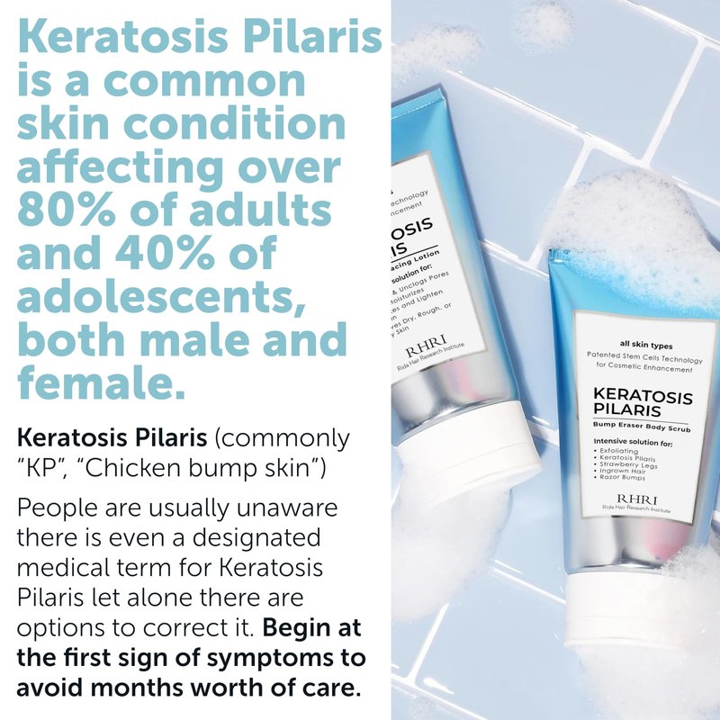 KP Bump Eraser Body Set with 10% AHA | Keratosis Pilaris Treatment | Keratosis Pilaris Lotion | Exfoliating Body Scrub | Ingrown Hair Treatment | Bundle Set for Bump, Strawberry Legs, Redness, Dryness