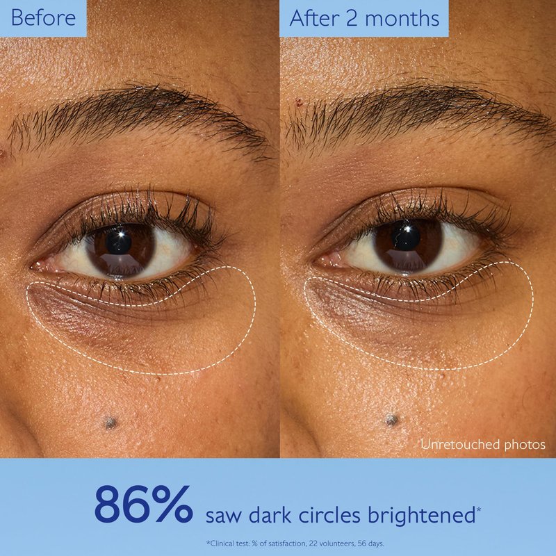 Caudalie Vinoperfect Dark Circle Brightening Caffeine Eye Cream with Niacinamide, Fragrance Free - 15 mL