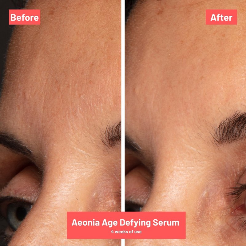 Aeonia Age-Defying Serum – Certified Space Technology Skincare, Age-Defying Face Serum with Bacillus Lysate, Resveratrol – Hydrates, Firms, Smooths Skin Texture & Reduces Fine Lines, 1 Fl Oz