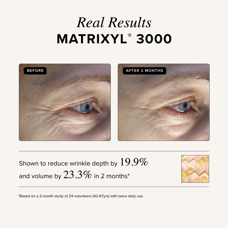 Asterwood Matrixyl 3000 + Argireline Serum for Face - Multi Peptide Serum with Hyaluronic Acid - Anti-Aging, Wrinkle Reducing, Collagen Boosting - Fragrance-Free - 8 Fl Oz