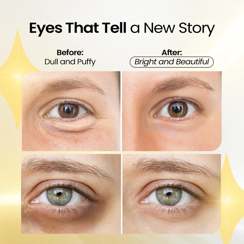 LA PURE Collagen Boosting Eye Mask Patches Under Eye Patches for Puffy Eyes Hyaluronic Acid Dark Circles Bags Lines Anti Wrinkles Anti Aging Hydrating Moisturizing Brightening Eye Gels 15ct