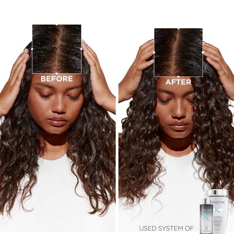 Kerastase Symbiose Antidandruff Hair Serum - Soothes & Hydrates Scalp | 3.04 Fl Oz
