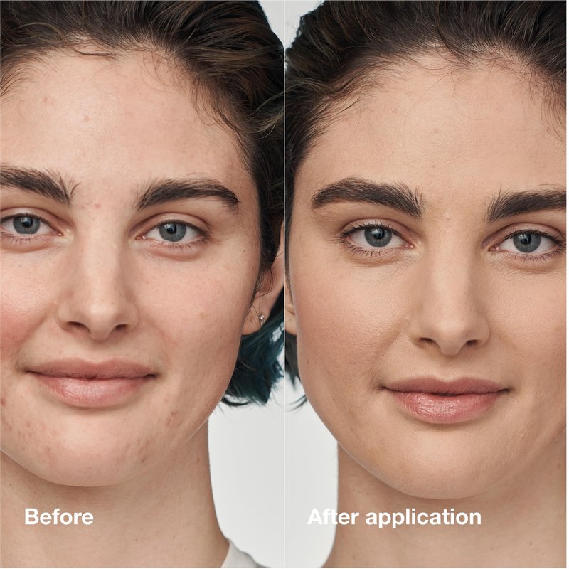 Clinique Even Better Clinical Serum Liquid Foundation SPF 25 With Vitamin C, Salicylic Acid + Hyaluronic Acid For Combination to Oily Skin Types | Full Coverage + Matte Finish, Porcelain Beige