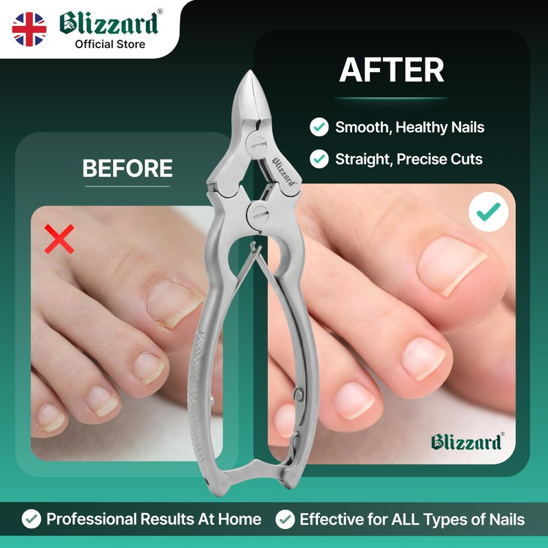Blizzard Toenail Clippers - Podiatrist Toe Nail Clippers for Thick Nails for Seniors - German Forged Nail Cutter - Heavy Duty Double Action Nail Clippers for Men with Toenail File - 6" Double Spring