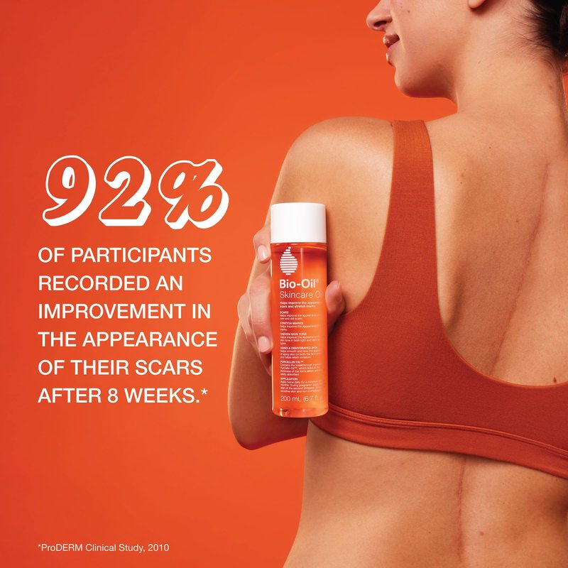 Bio-Oil Skincare Body Oil Serum for Scars and Stretch Marks, Face and Body Moisturizer with Vitamin E & A for Sensitive Dry Skin, Dermatologist Recommended, Non-Comedogenic, 4.2 Oz