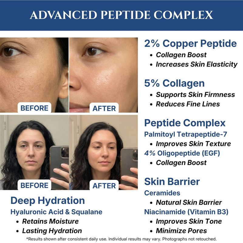 Copper Peptides Serum for Face, 2% Copper Peptide with 4% Epidermal Growth Factor (EGF Serum), Niacinamide, Ceramides, Squalane & Hyaluronic Acid, Multi Peptide, Collagen Peptide Complex, 1 fl oz
