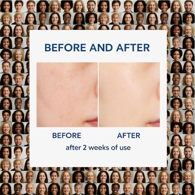 Alpha Skin Barrier Cream - Moisturizing Lotion for Dry, Sensitive Skin | 80ml Face & Body Care