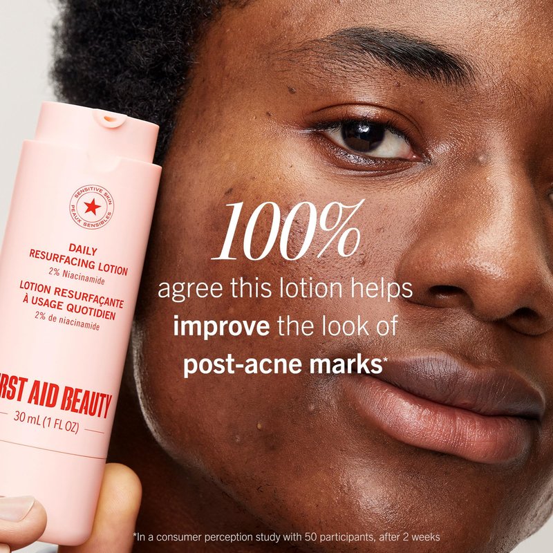 First Aid Beauty Lactic Acid Lotion for Acne-Prone Skin, 2% Niacinamide Resurfacing Moisturizer, Visibly Diminishes Post-Acne Marks, Safe for Sensitive Skin, 1 oz
