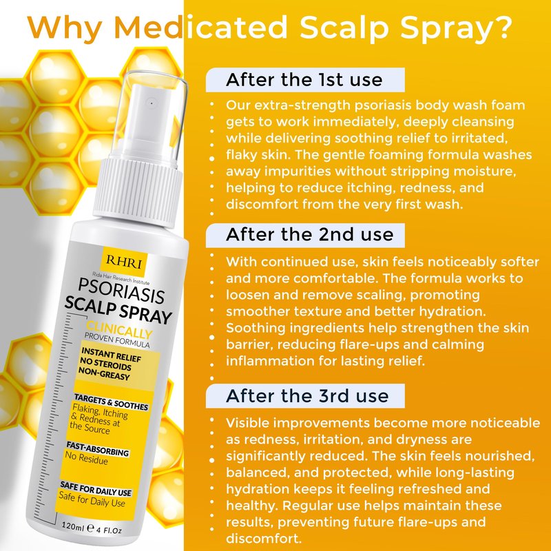 Psoriasis Scalp Spray | Psoriasis and Dandruff Treatment for Scalp Yeast Infections, Psoriasis Flare-Ups & Folliculitis | Antifungal Ringworm Itchy Scalp Spray for dryness