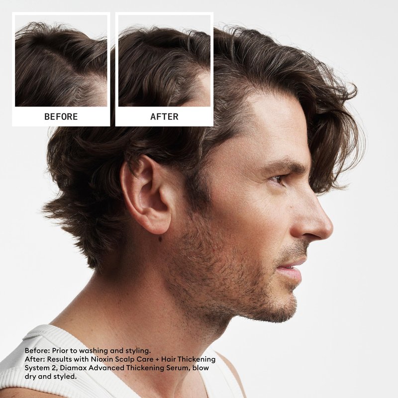 NIOXIN Scalp + Hair Thickening System 2 Shampoo| For Natural or Untreated Hair with Progressed Thinning |With Niacinamide and Biotin |10.1 Fl oz.