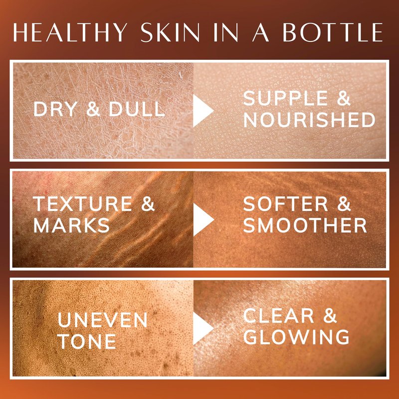 Bio+ Skin Moisturizer Body Oil for Women - Coconut, Jojoba, Olive & Almond Oils for Scars & Stretch Marks, Vanilla Scent & Vitamin E, Bio Oil Skincare, Stretch Mark Treatment