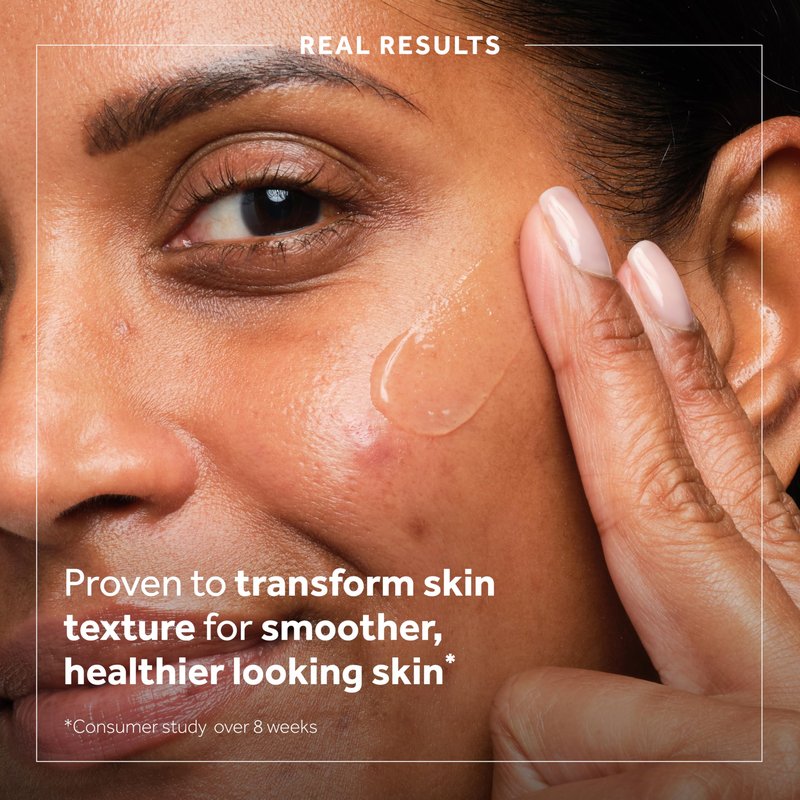 No7 Derm Solutions AHA Exfoliant & Face Toner with Lactic & Glycolic Acid - AHA Smoothing Treatment - Controls Oil and Minimizes Pores - for Oily & Blemish-Prone Skin (1 Fl Oz)
