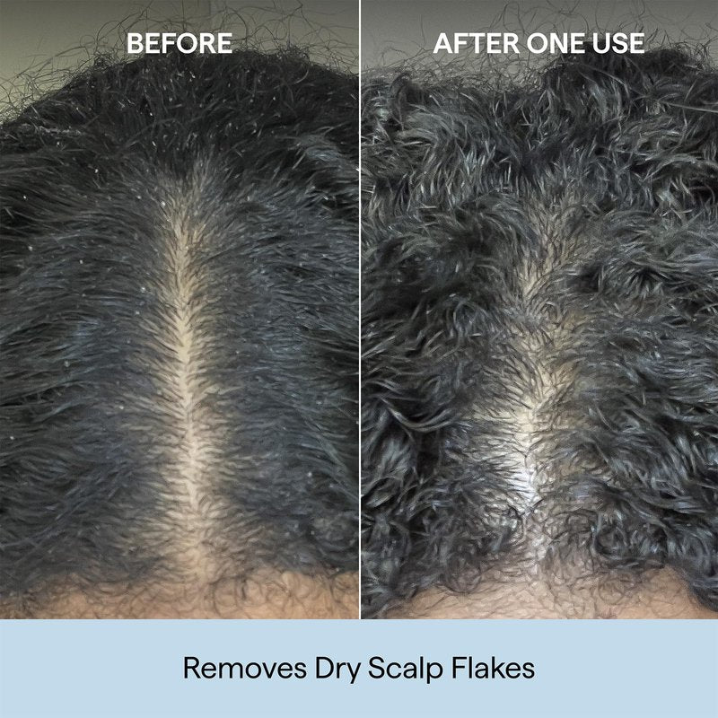 Briogeo Scalp Revival Charcoal + Coconut Oil Micro-Exfoliating Shampoo | Sulfate-Free Scalp Scrub for Dry, Itchy, or Oily Scalp | Detoxifying & Hydrating | Vegan & Cruelty Free | 2 oz