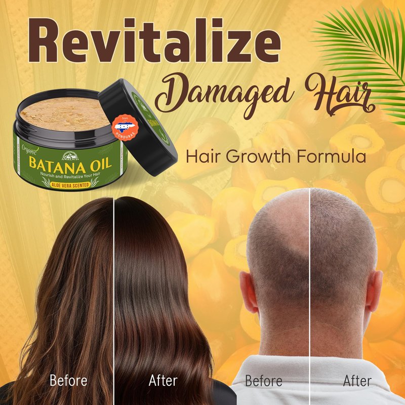 Raw Batana Oil for Hair Growth & Scalp Stimulator – 100% Pure Hair Oil from Honduras – Dr. Sebi Organic Paste – Natural Hair Growth Products for Thicker Edges, Breakage & Split Ends (16, Ounces)