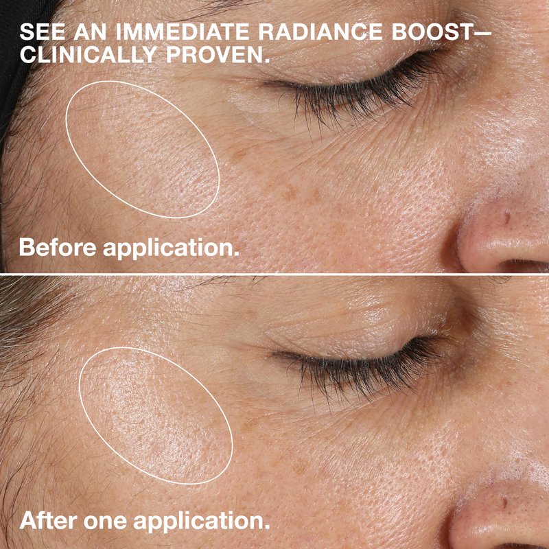 Clinique Clarifying Lotion 2 | Gentle Exfoliator For Dry Combination Skin Types | Face Toner With Witch Hazel | Step 2 in 3-Step Skin Care Routine, 6.7 Fl Oz