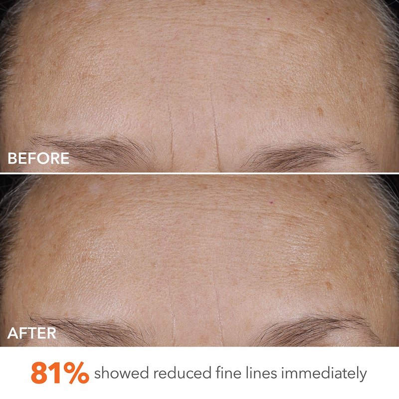 Dr Dennis Gross DermInfusions Blur + Repair Cream, Instantly Blurs Fine Lines, Smooths Skin with Satin-Matte Finish, Visibly Plumps & Firms & Improves Skin Elasticity, 0.67 Fl Oz